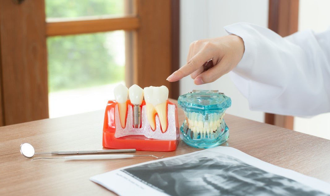 How to Clean Your Dentures at Home (Alternatives) - XODENT