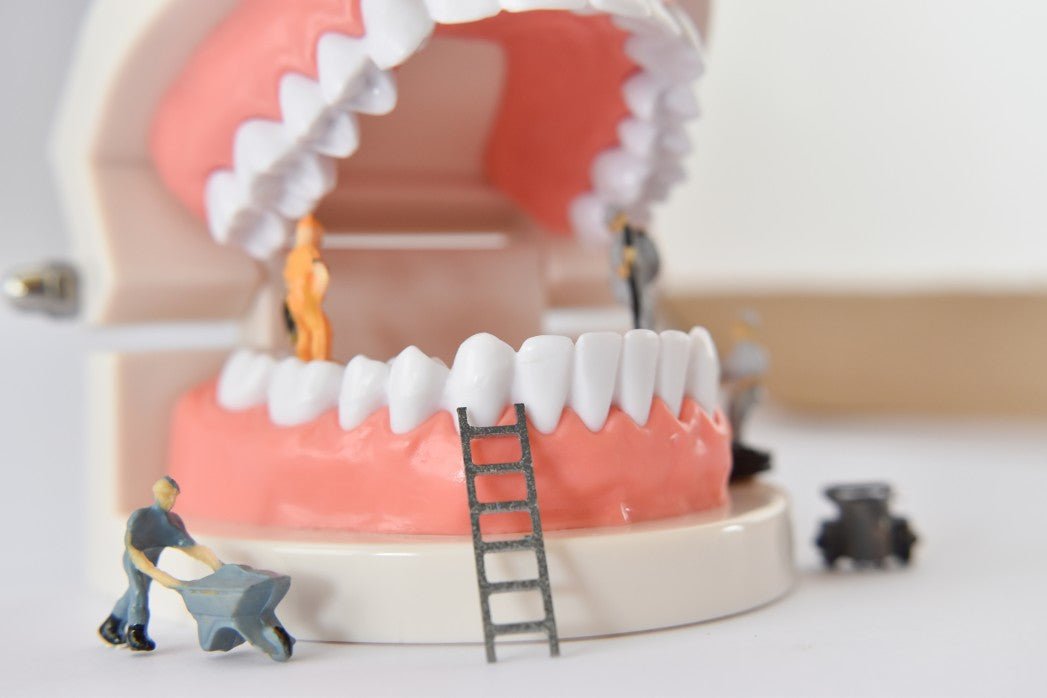 Top Denture Repair Tips: A Complete Guide That You Need to Read - XODENT